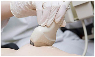 腹部エコー検査