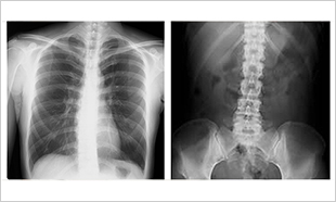 レントゲン検査